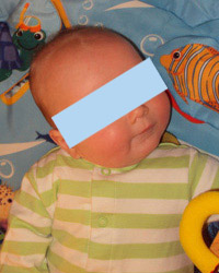 torticollis muscular baby tilt head congential overview notice common sign congenital
