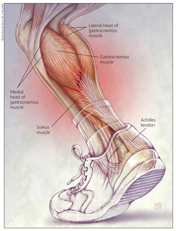 left achilles pain