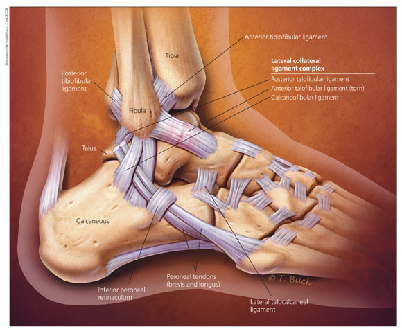 pain in heel radiating up leg