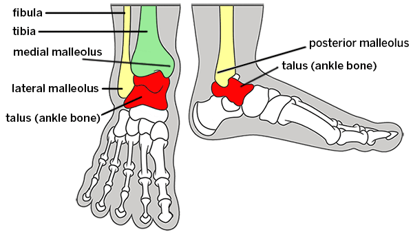 Broken Ankle Types Of Fractures Diagnosis Treatments