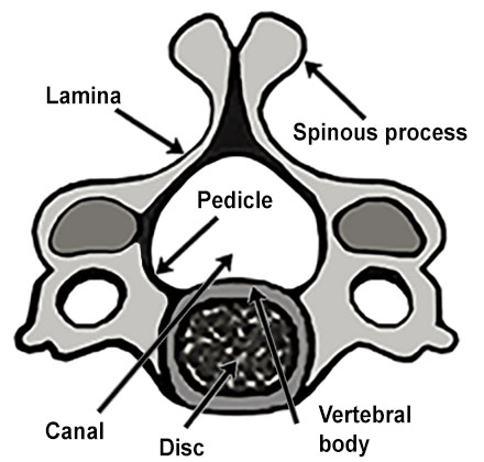 Illustration of a cross-section of a cervical spinal vertebra.