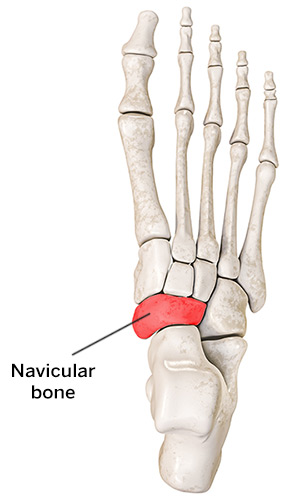 Bones of the foot with navicular highlighted.
