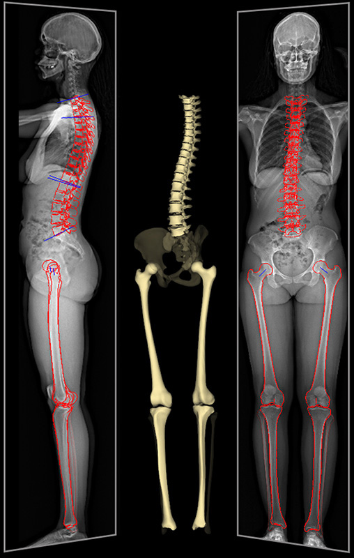 This total body scanner shows 3D images of the whole body