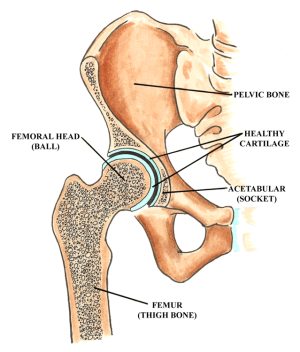 Hip Pain Location Diagram