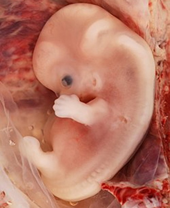 Human embryo photo.