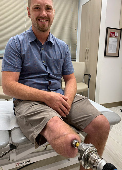 Photo of Jesse Frye, below-the-knee osseointegration limb replacement patient.