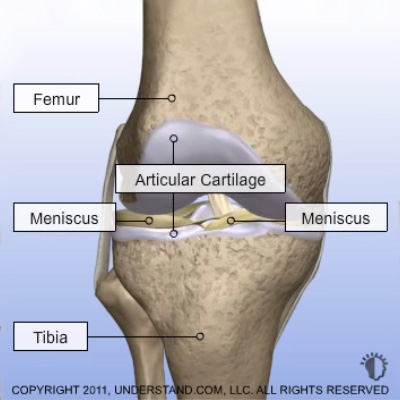 Image: illustration of the knee with the femur, tibia, articular cartilge and menisci labeled.