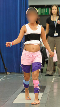 A young female patient having her gait analyzed