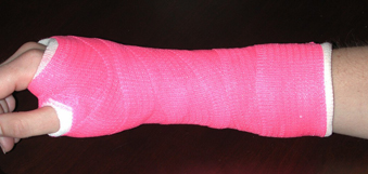 How long does it take a wrist fracture to heal?