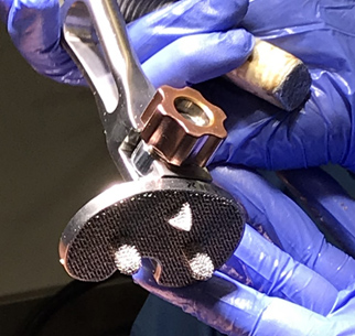 Photo of a prototype cementless, porous tibial component knee replacement