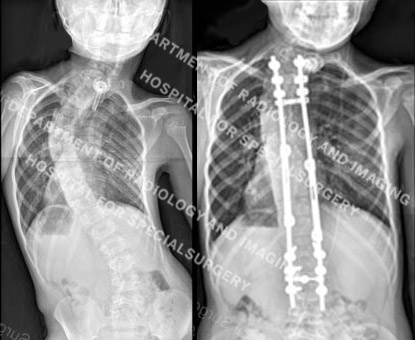 X-ray images.