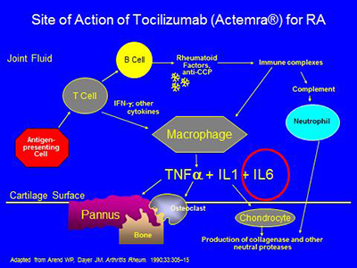 Site of action of tocilizumab for RA