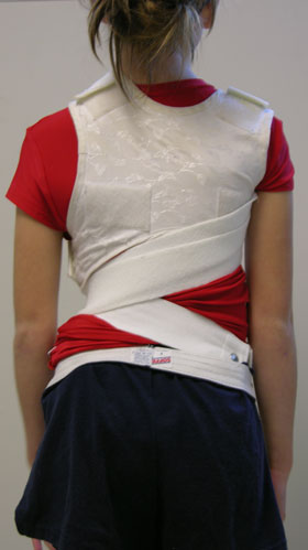 Photo of a patient wearing a rigid, flexible brace, rear view.