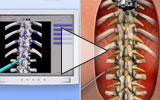 Play the animation - computer assisted spine surgery