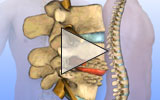 Osteoarthritis animation video