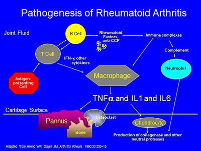 pathogenesis of RA
