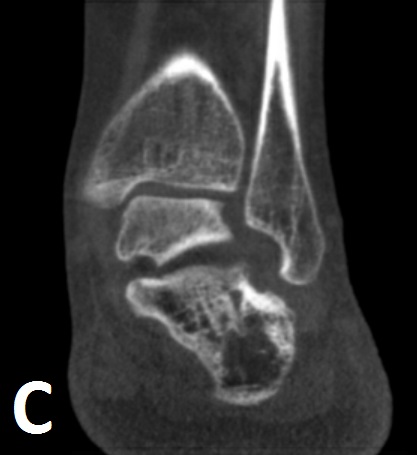 fig2c