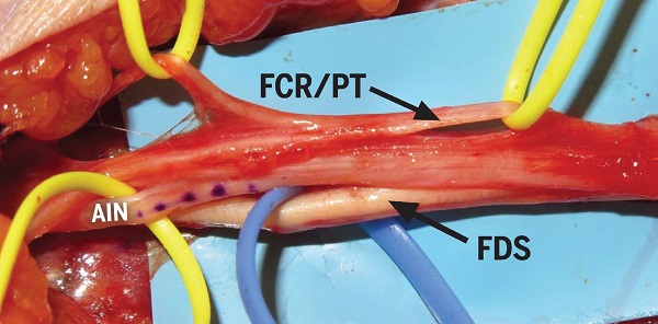 fig2