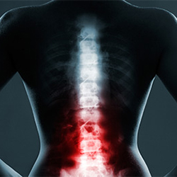 a red highlighted spine shows lumbar spine pain