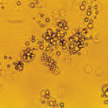 Image depicting the interaction of cells with implant debris particles that collect around prostheses