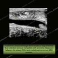 Image - Ultrasound of the Month Case 35 thumbnail