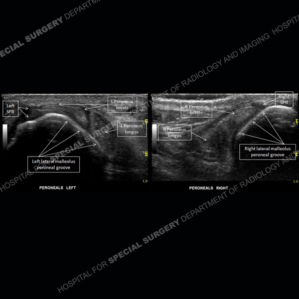 Image - Ultrasound of the Month Case 73 thumbnail
