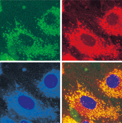 Nanoparticles indicate inflammation in cells, the first sign that osteolysis will develop