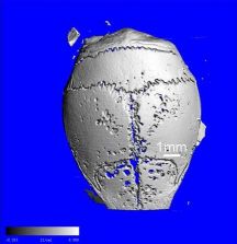 Graphic: Mouse calvaria - particle-induced osteolysis