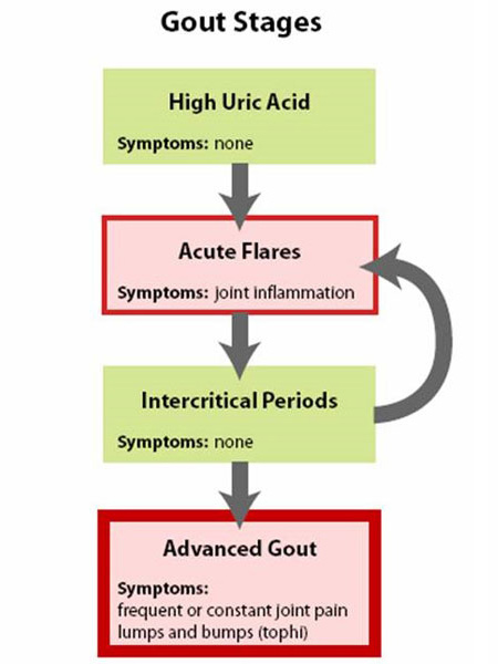 What are treatment options for gout in the shoulder?