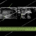 Image - Ultrasound of the Month Case 40 thumbnail