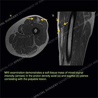 Image - Ultrasound of the Month Case 49 thumbnail