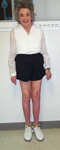 Edith, Follow up thumbnail image, Limb Lengthening, Total Knee Replacement