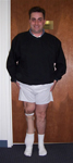 Steven, Follow up thumbnail image, Limb Lengthening, leg straightened, arthritis prevention