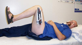 Andrew, Post-Op thumbnail Image, Limb Lengthening, osteotomy, distal femur, minimally invasive surgery 