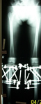 Zaida, Post Op thumbnail of an x-ray Image, Limb Lengthening, bilateral tibia and fibula osteotomies