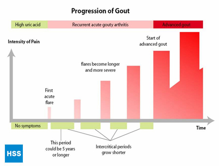 Chart diagramming the progression of gout