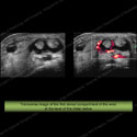 Image - Ultrasound of the Month Case 5 thumbnail