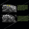 Image - Ultrasound of the Month Case 68 thumbnail