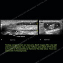 Image - Ultrasound of the Month Case 76 thumbnail