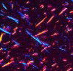Photo of Uric Acid Crystals under Polarizing Light Microscopy