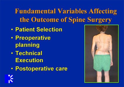 List of fundamental variables affecting the outcome of spine surgery.