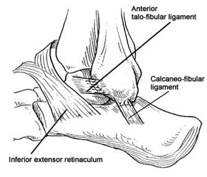 Line drawing showing anatomic reconstruction