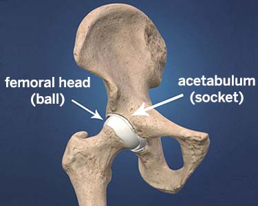 Illustration: anatomy of the hip joint showing the pelvis and femur, with the femoral head (ball) and acetabulum (socket) labeled