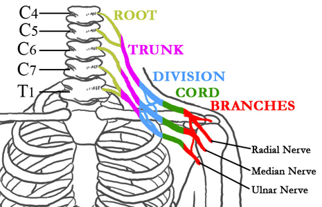 Brachial Plexus Injuries: New Advances in Treatment