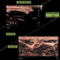 Image - Ultrasound of the Month Case 29 thumbnail