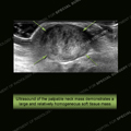 Image - Ultrasound of the Month Case 30 thumbnail