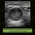 Image - Ultrasound of the Month Case 31 thumbnail