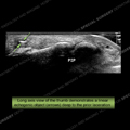 Image - Ultrasound of the Month Case 37 thumbnail