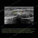 Image - Ultrasound of the Month Case 47 thumbnail