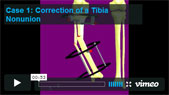 Image indicating link to animation video.